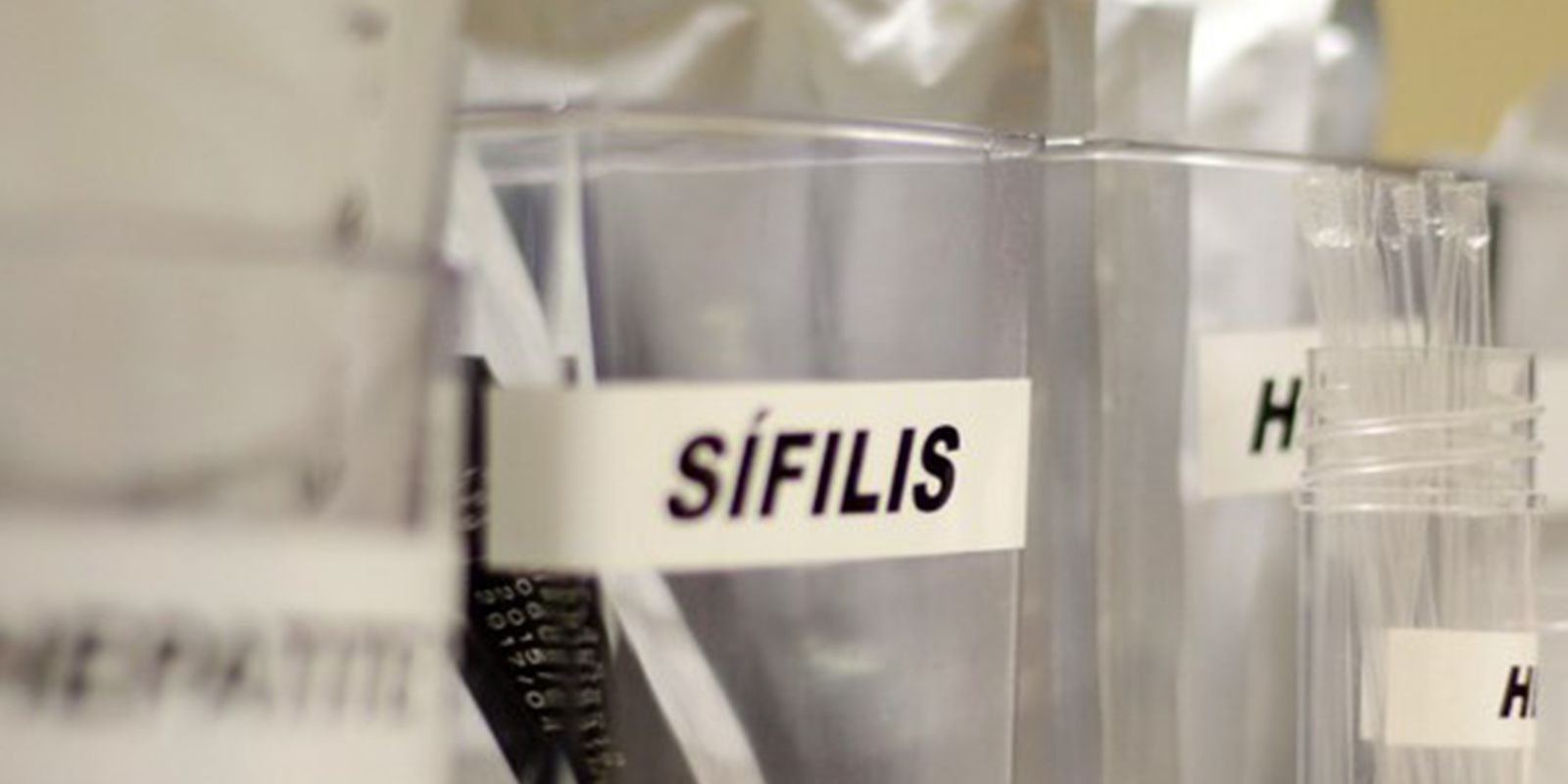 Ministério da Saúde lança campanha de enfrentamento à sífilis